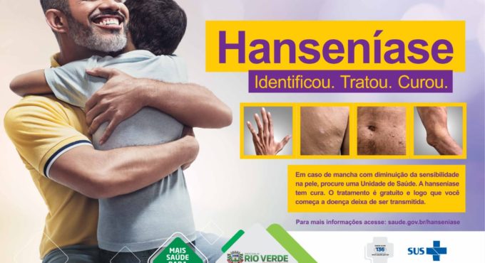 Janeiro Roxo alerta para a conscientização sobre a hanseníase